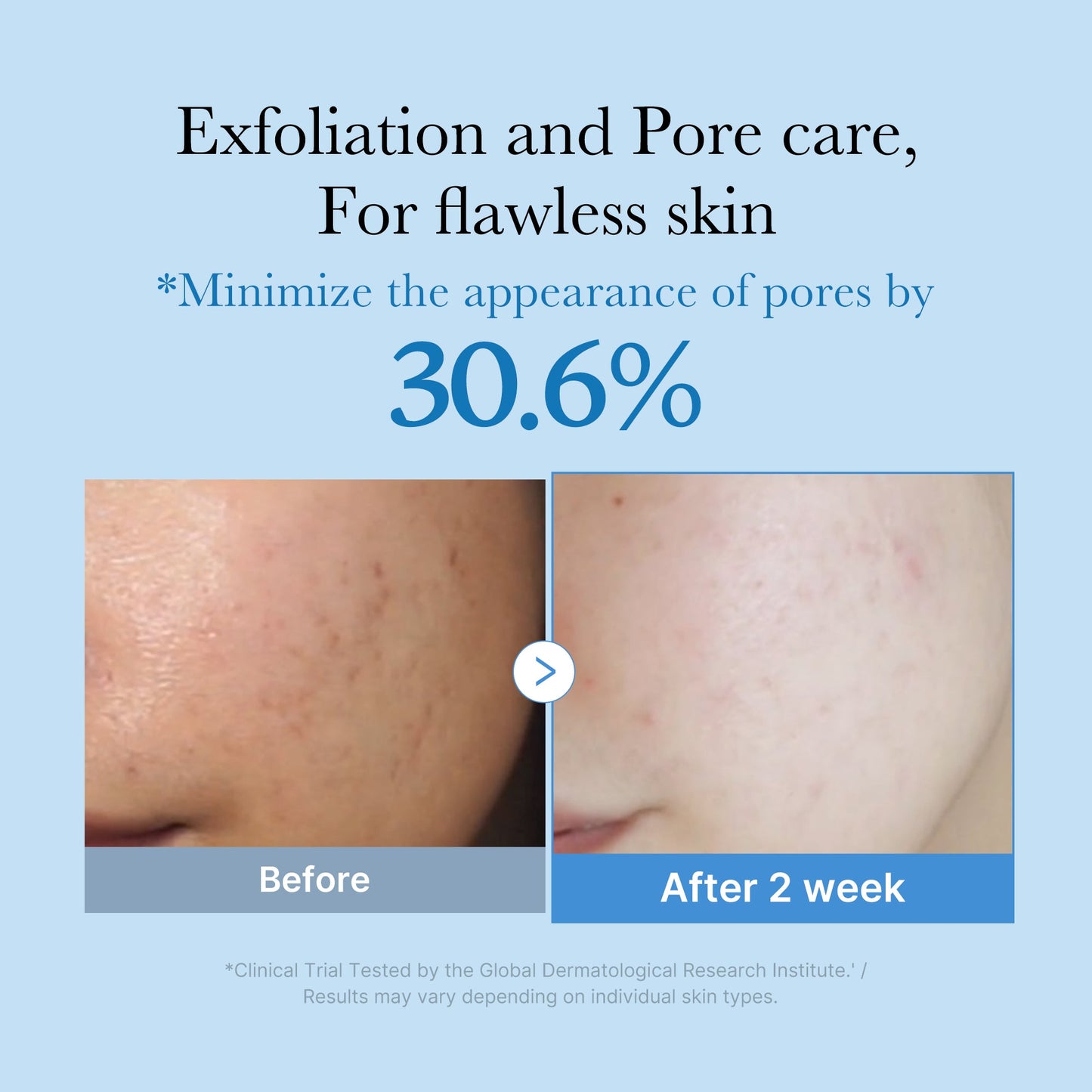zero-pore-toner-i5 01_d6480b4e-3c08-4954-994a-ed5212c1839c.jpg