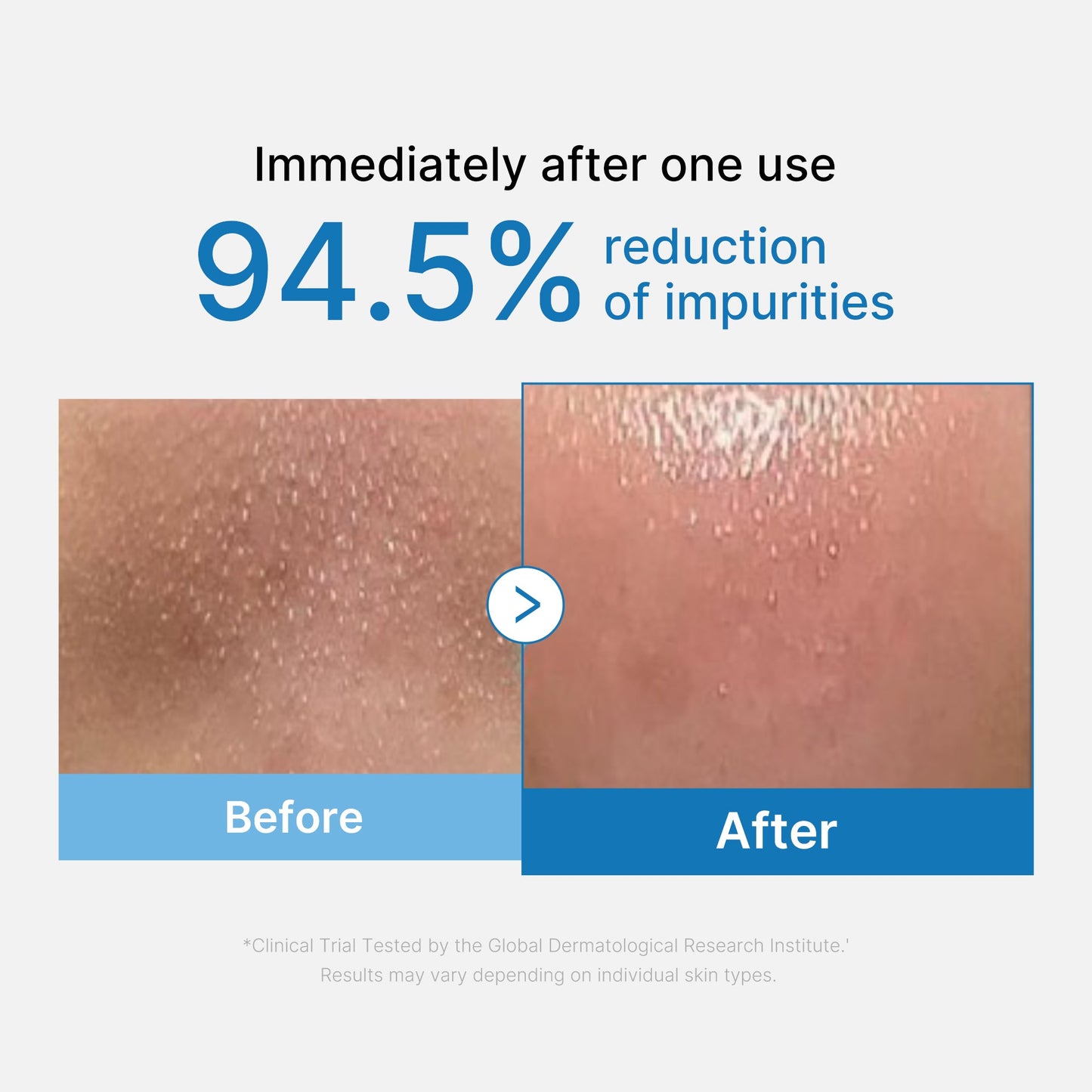 zero-pore-blackhead-deep-cleansing-oil-v2 01_eed557ec-5857-46a2-8b17-dbd67c692dcb.jpg