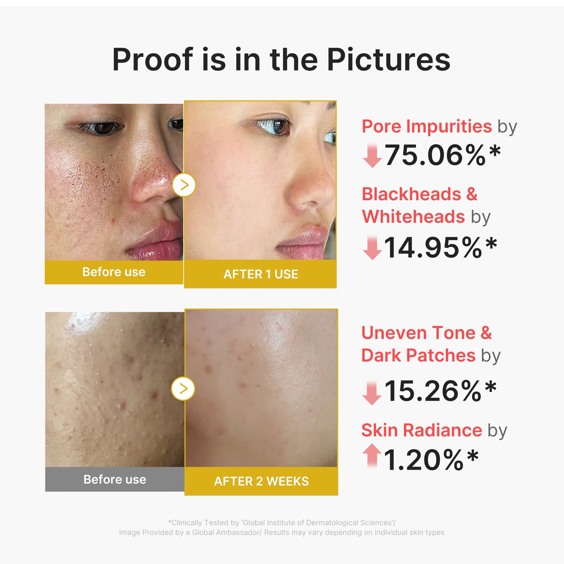 kojic-acid-turmeric-peel-shot-t6 02_45fe66d3-b3f6-4100-aa52-2afd7eded417.jpg