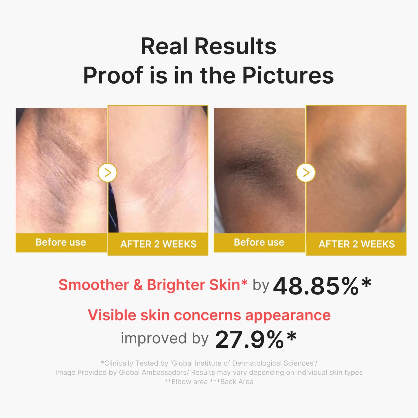 kojic-acid-turmeric-body-peel-shot-i4 02_72880cfc-382b-440b-8152-7e3dce87da2a.jpg