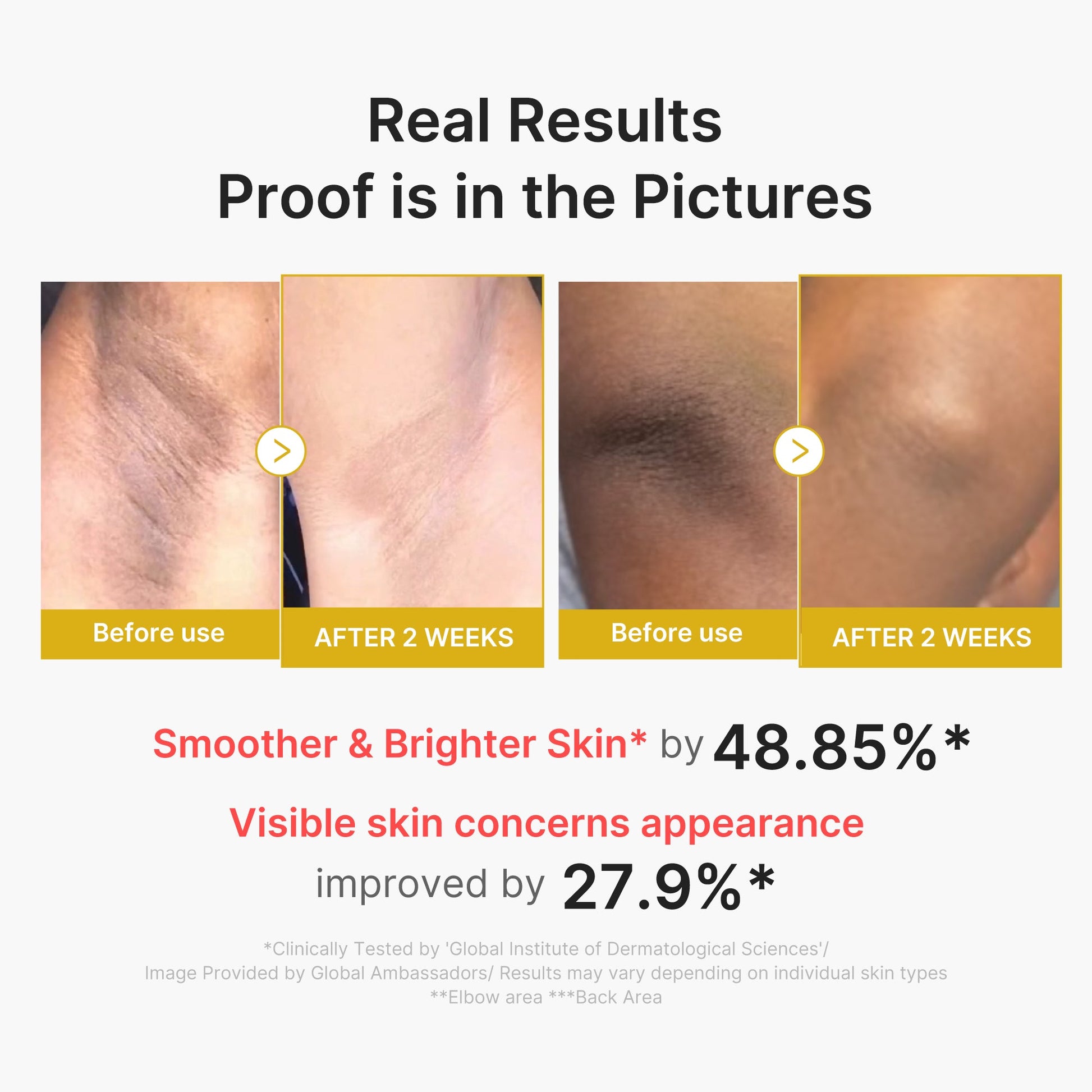 kojic-acid-turmeric-body-peel-shot-i4 02_72880cfc-382b-440b-8152-7e3dce87da2a.jpg