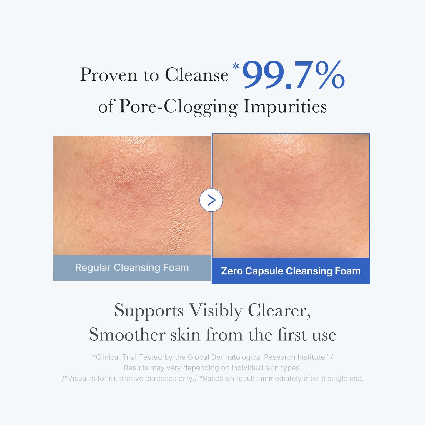zero-pore-capsule-cleansing-foam-c2 02_c1fb9dfb-86c5-4038-8ff8-490d1006276c.jpg