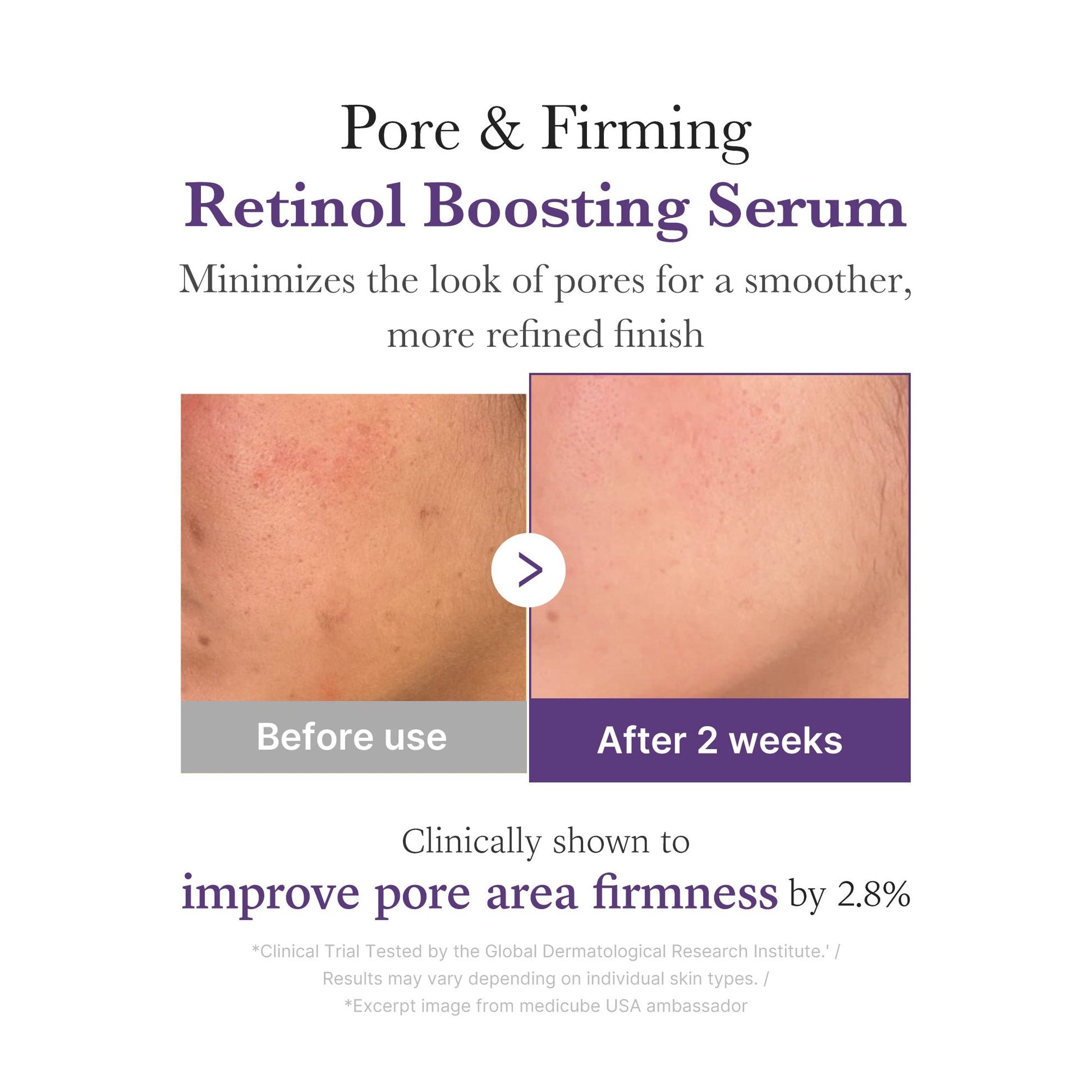retinol-nmn-boosting-serum-g3 03_3510e7a5-5633-4a18-81ea-1389593bd517.jpg