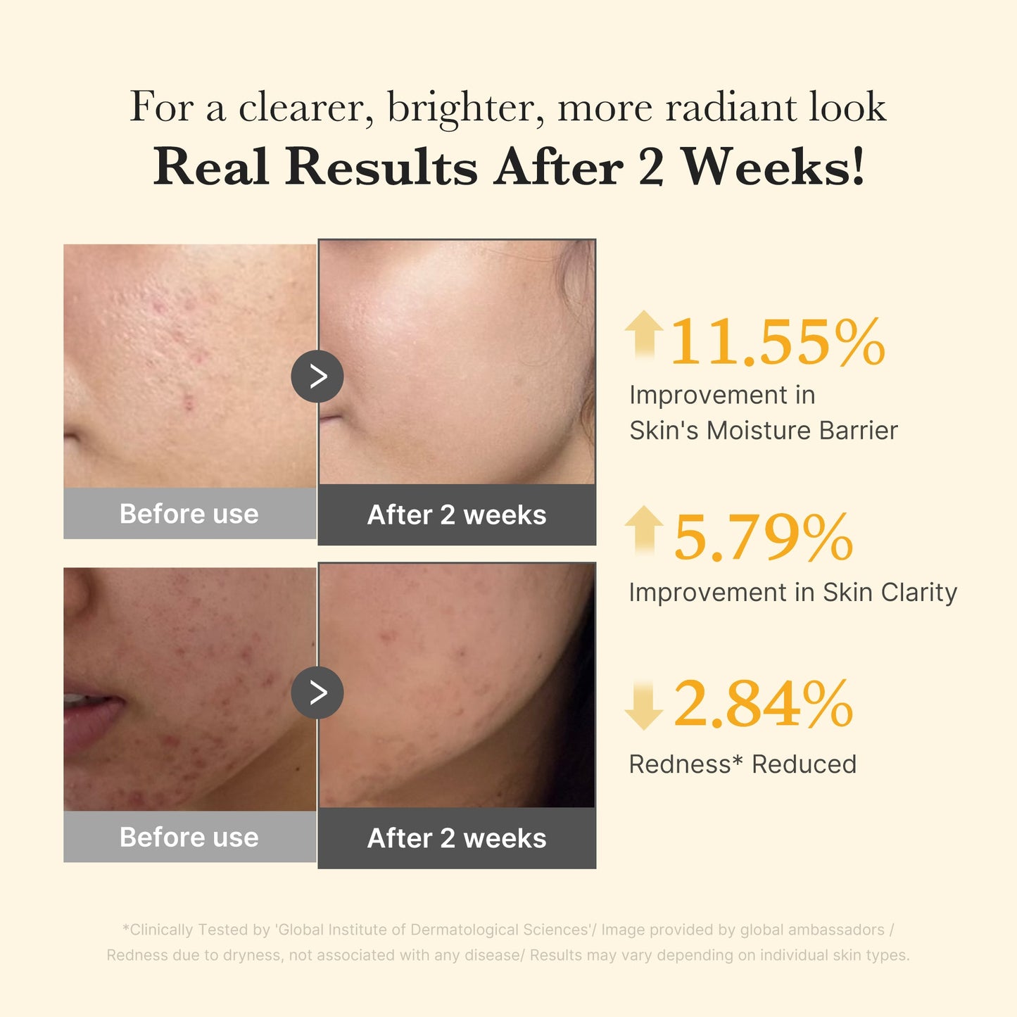 kojic-acid-turmeric-capsule-serum-i7 03_436487f5-76df-490e-8a61-01118373efbd.jpg