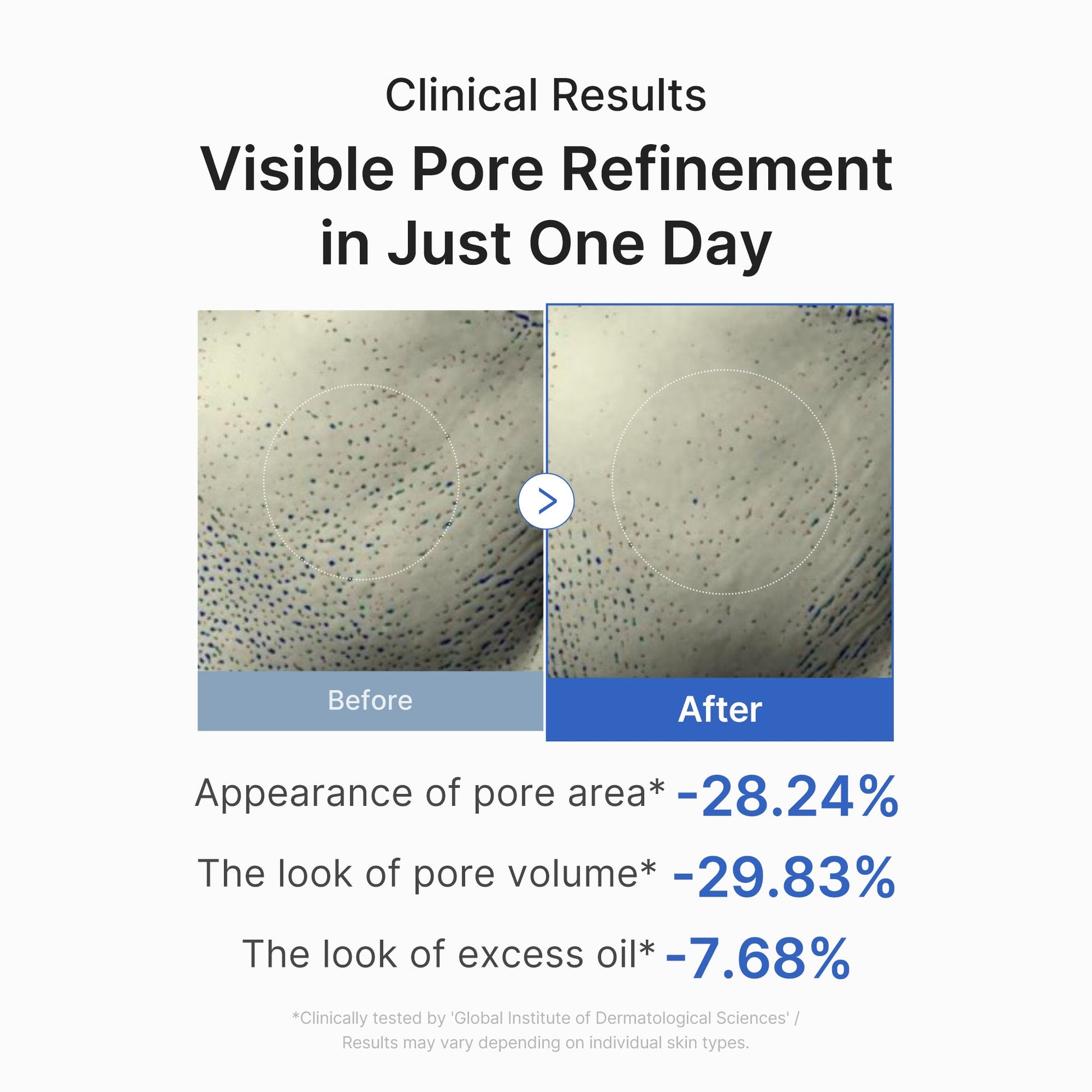 zero-pore-one-day-peptide-serum-a6 03_448eab9e-dc60-4dcb-9e4e-e863aabb61b0.jpg