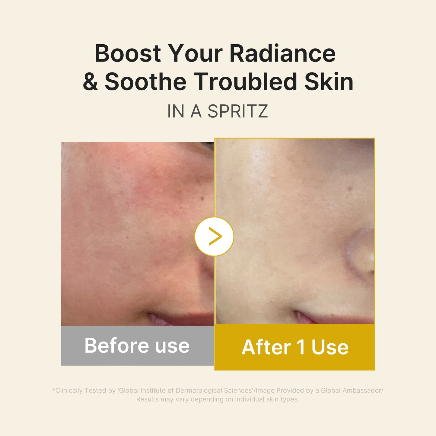 kojic-acid-turmeric-vitamin-gold-jelly-mist-serum-c2 03_dc9cd19e-4e57-49d3-9b66-c7762e8a63f1.jpg