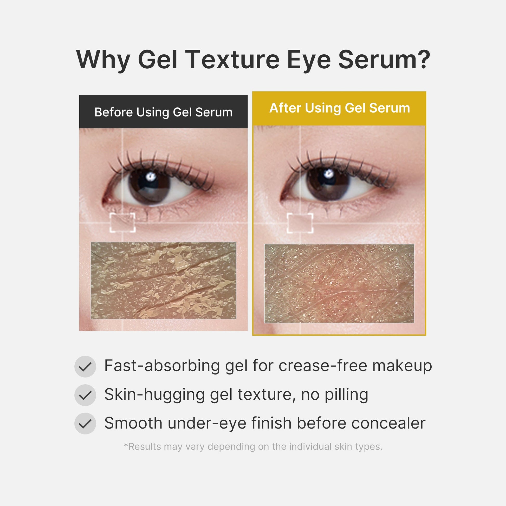 kojic-acid-tumeric-eye-gel-serum-b7 04_0487ef36-49f4-4294-8049-bb55118b05fe.jpg