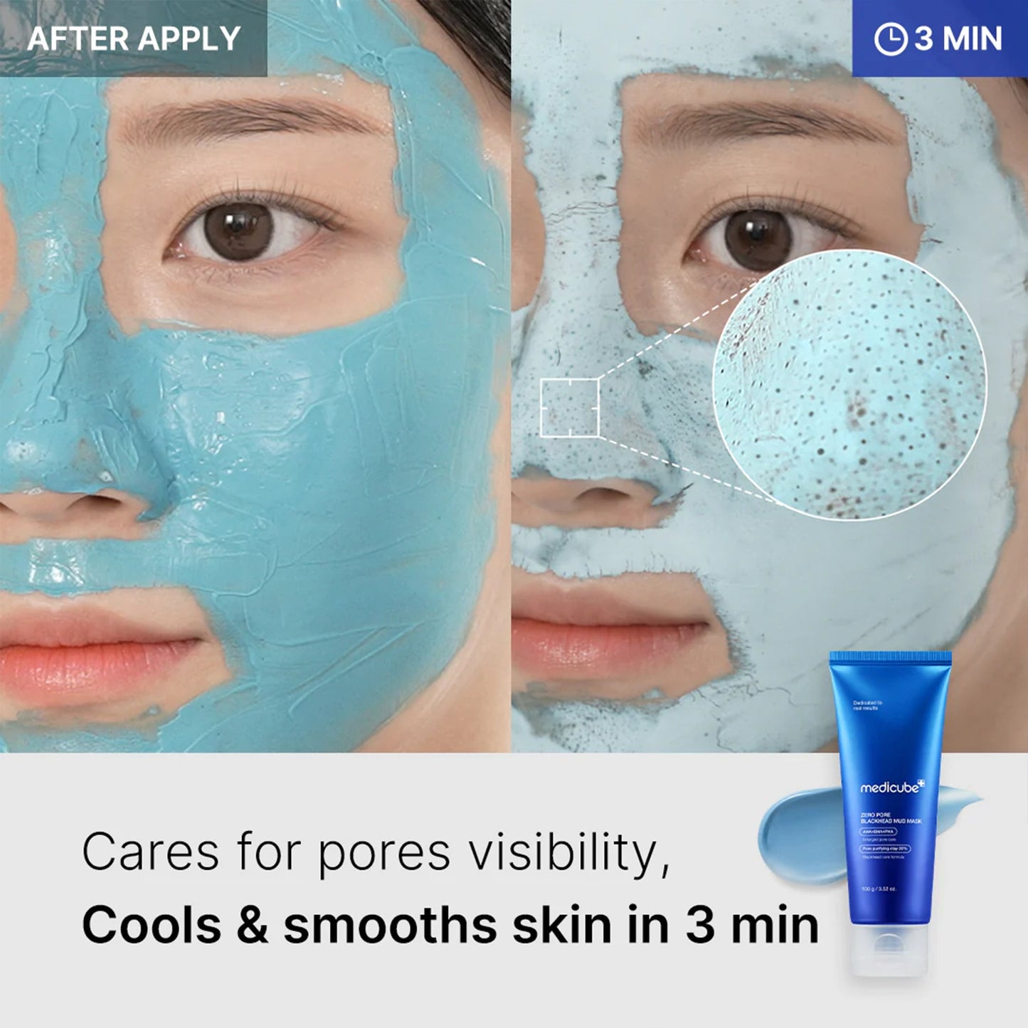 zero-pore-blackhead-mud-mask-j3 04_867c0459-a94e-40d3-bd9a-70400edabe8d.jpg