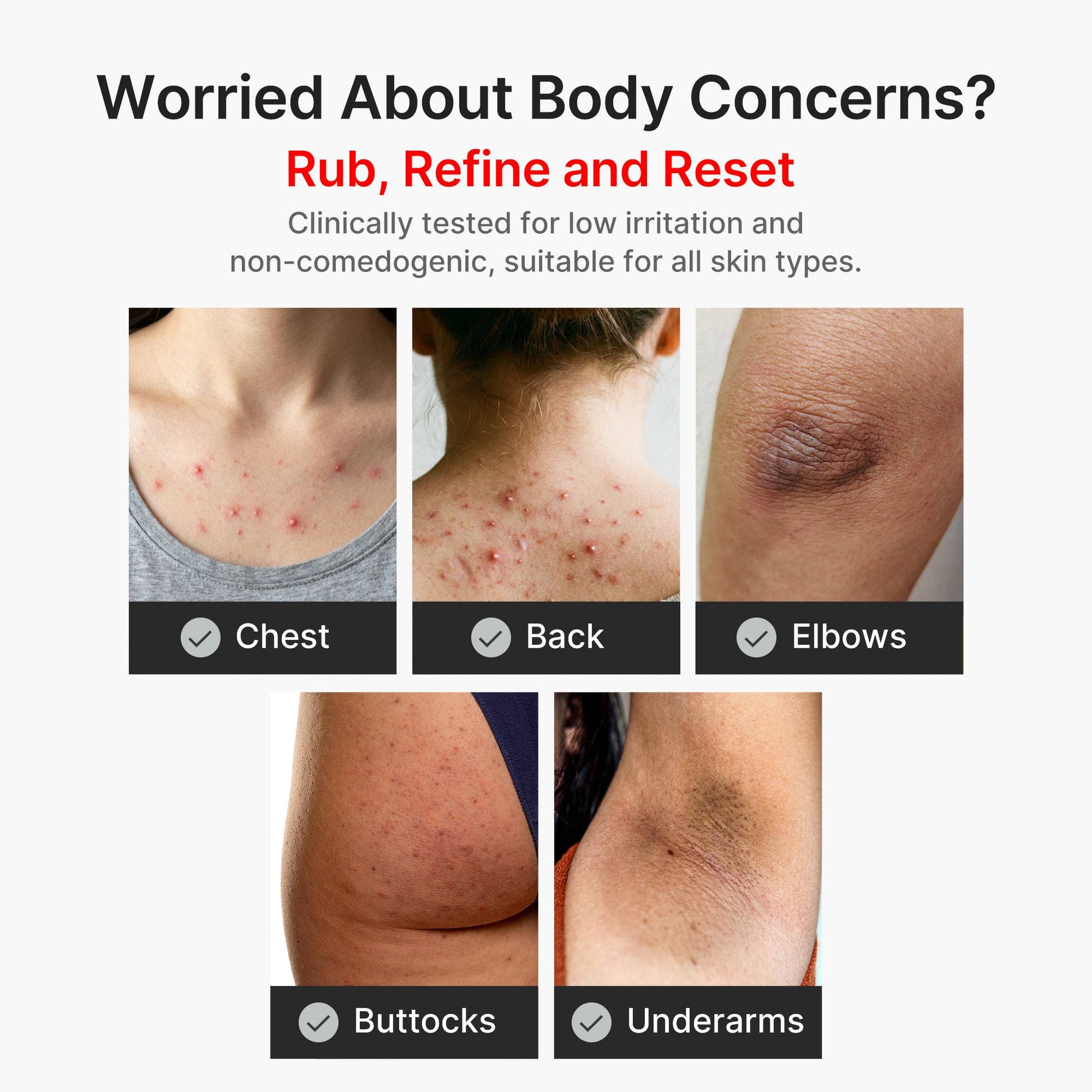 kojic-acid-turmeric-body-peel-shot-i4 04_8a7237f2-3ebf-401e-bd85-54841aeb3efc.jpg