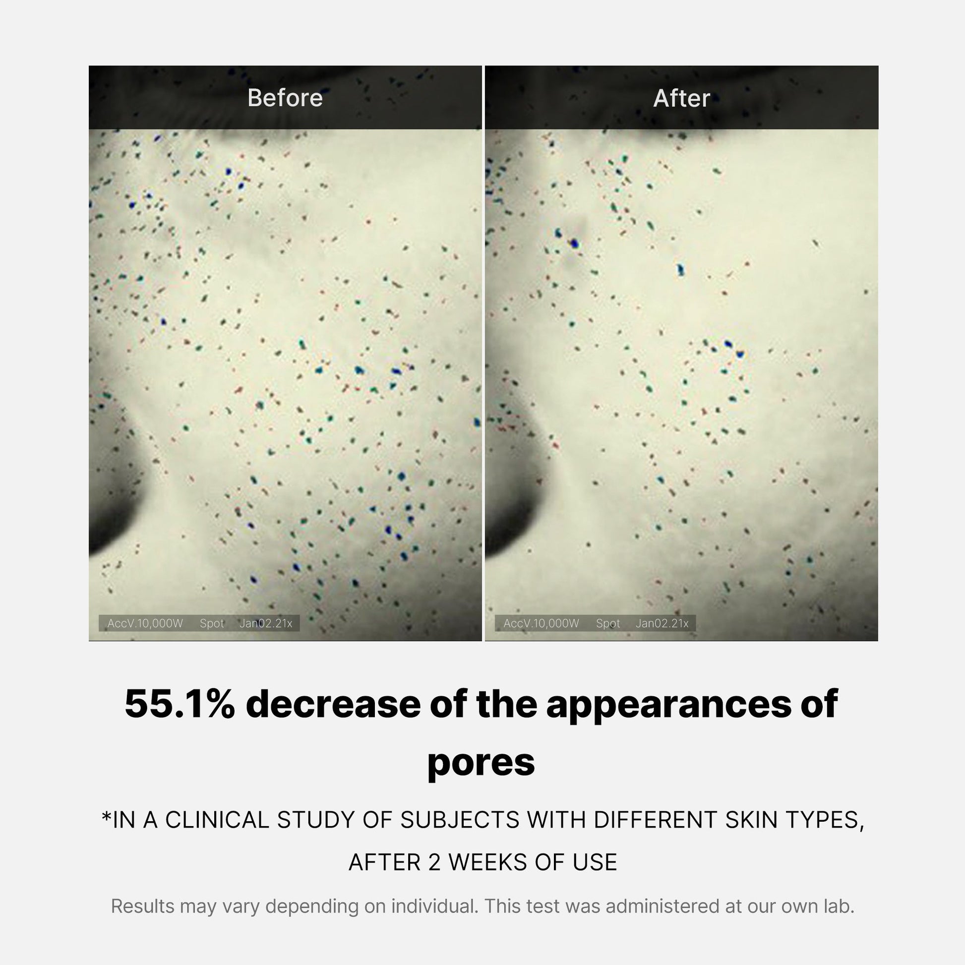 pore-care-duo-f5 05_12ddab8a-64be-4612-8ee1-27e5ec701921.jpg