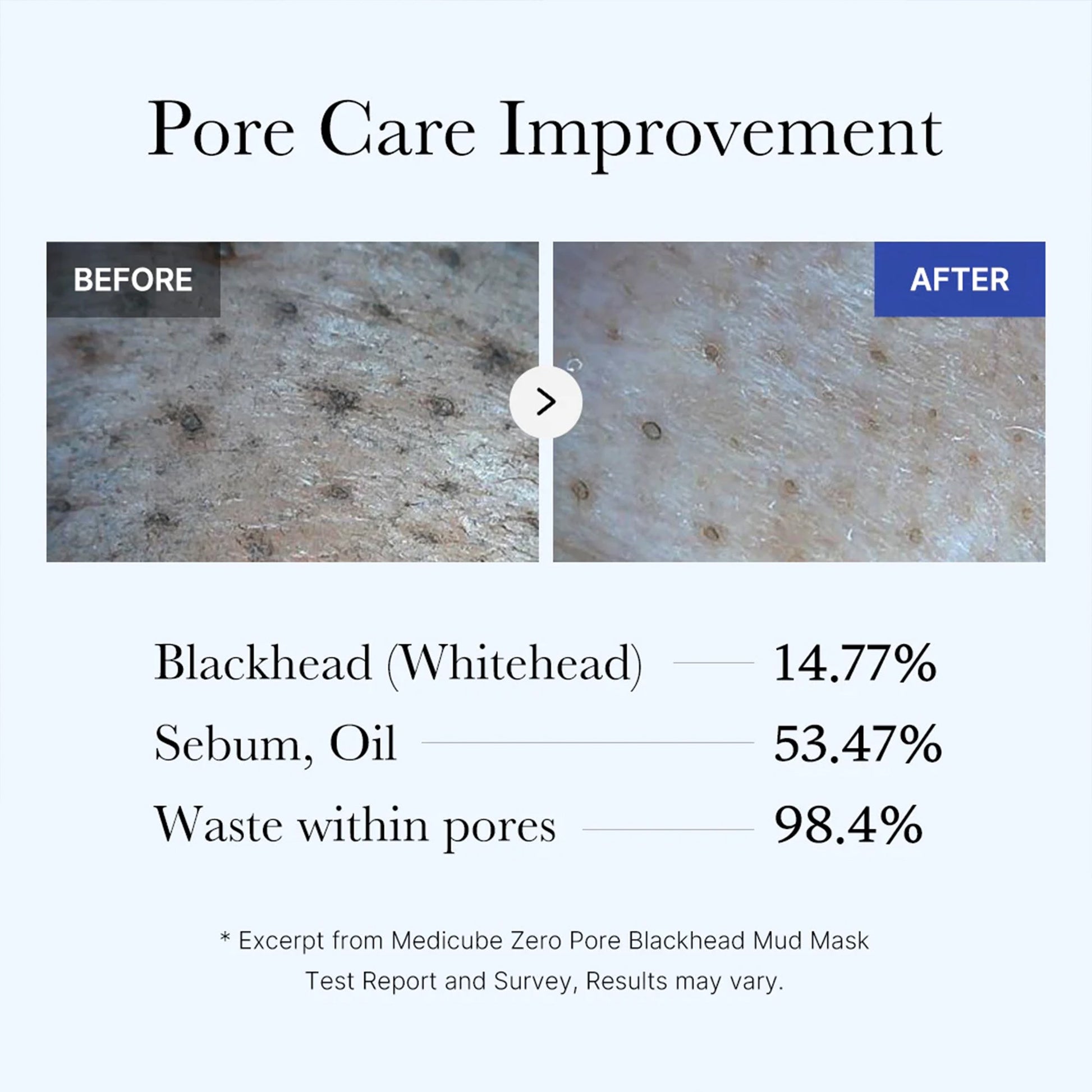zero-pore-blackhead-mud-mask-j3 05_9362a158-c2b3-4525-acc0-631a2cfdea47.jpg