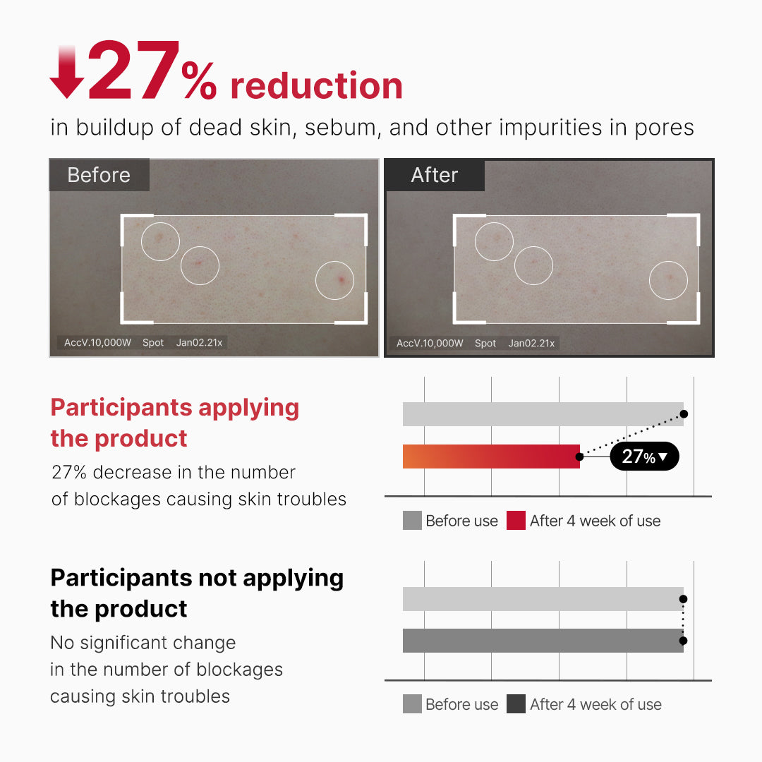 red-body-peeling-shot-cleanser-t4 07_60b5b2fd-b0f0-4cae-b358-5c38181e8dd8.jpg