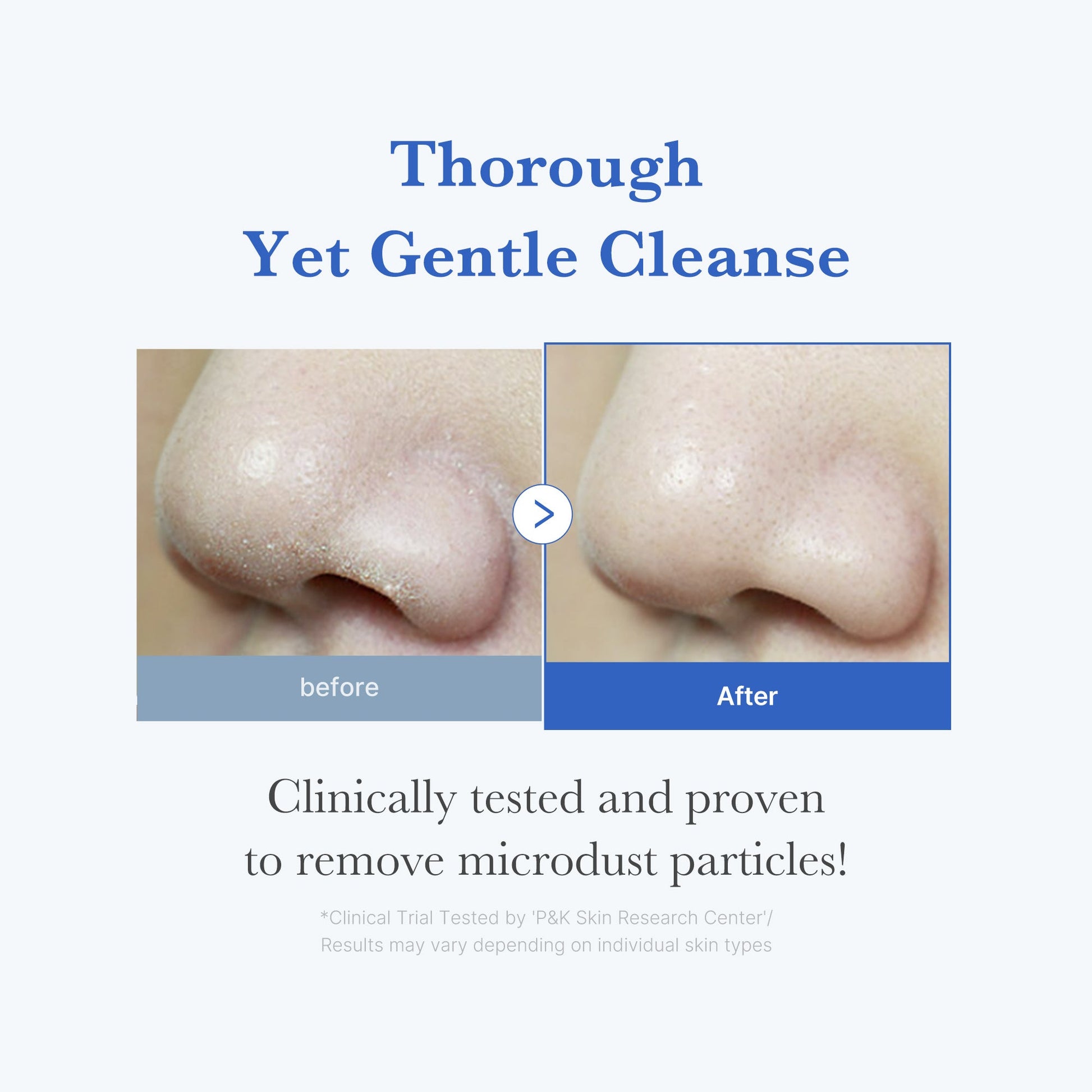 zero-foam-cleanser-m1 250702_ZeroCleanser3.jpg
