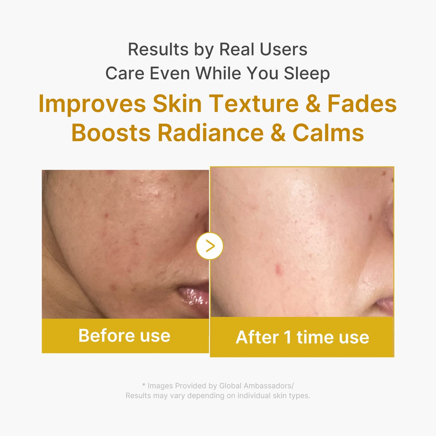 kojic-acid-turmeric-overnight-wrapping-mask-o4 2_04.jpg