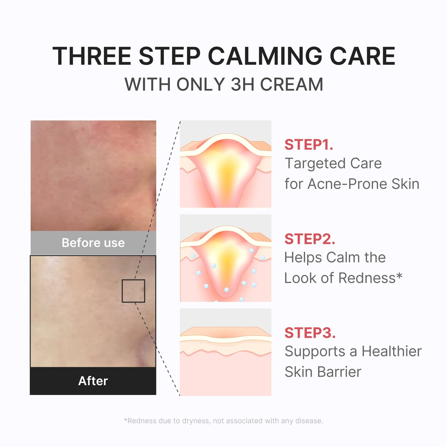 3h-daily-relief-cream-w4 3H_04.jpg