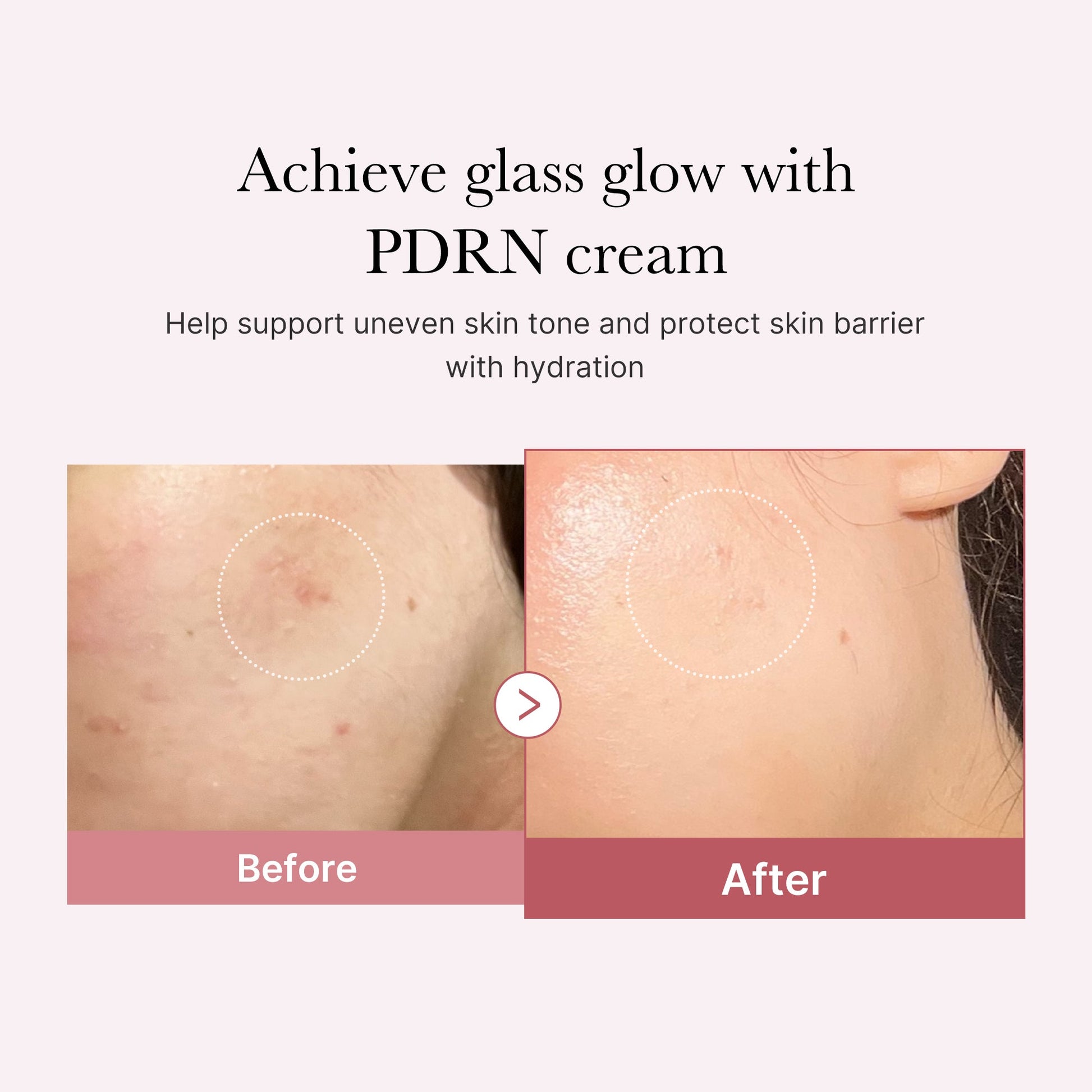 pdrn-pink-peptide-cream-t7 PDRN_02_d7805bfe-cf43-446a-b71b-a276683f136b.jpg