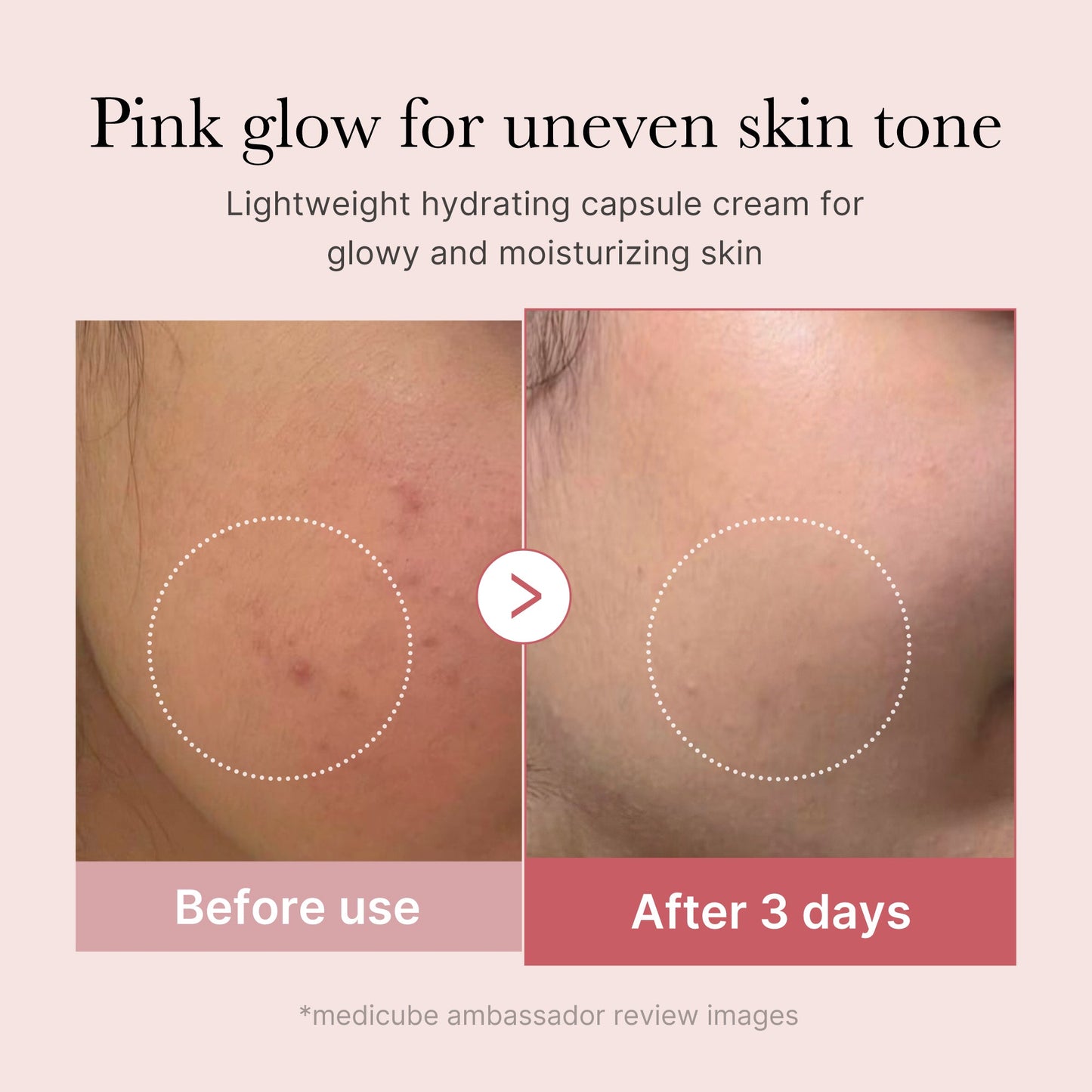 pdrn-pink-collagen-capsule-cream-a1 PDRN_03_058d09d8-4f44-4b1e-927c-e27b1738ae51.jpg