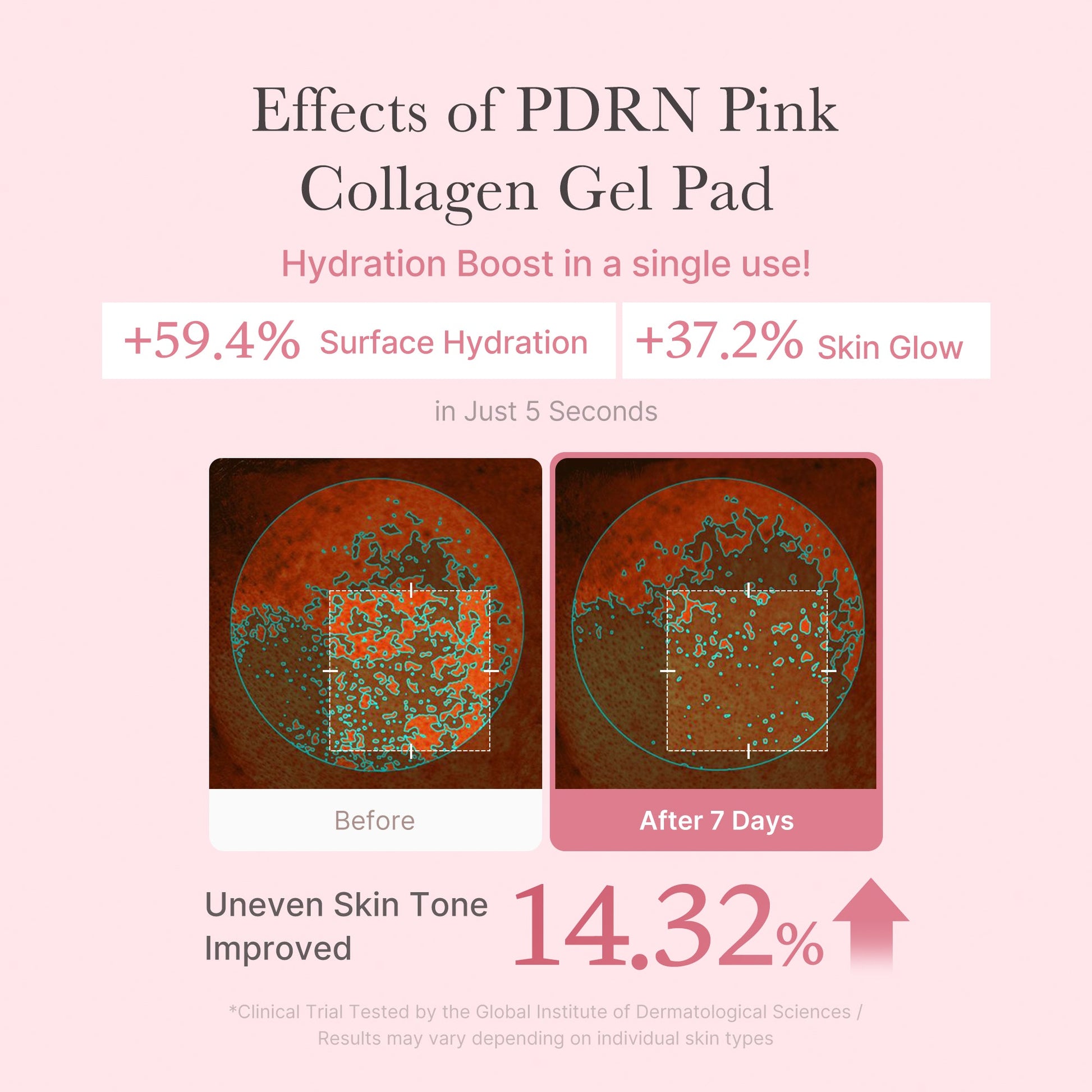 pdrn-pink-collagen-gel-toner-pad-g7 PDRN_04_f9a16a56-8d9e-4c47-a635-ed34ec3ed571.jpg