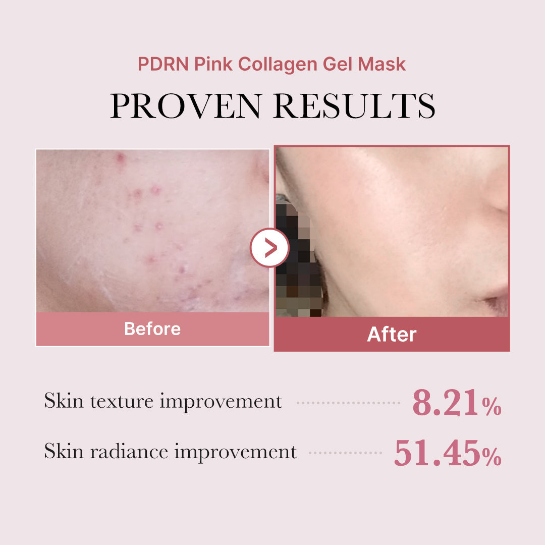 pdrn-pink-glow-full-set-i7 PDRN_12.jpg
