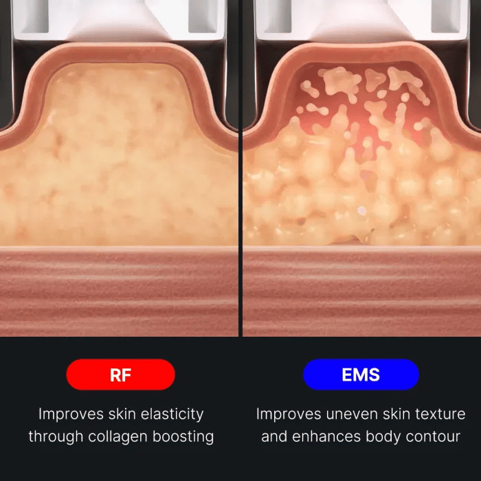 age-r-contour-body-shot-k6 img.webp